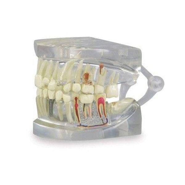 Clear Dental Model Human Body Anatomy Replica Of Jaw Teeth For Dentist Office Educational Tool