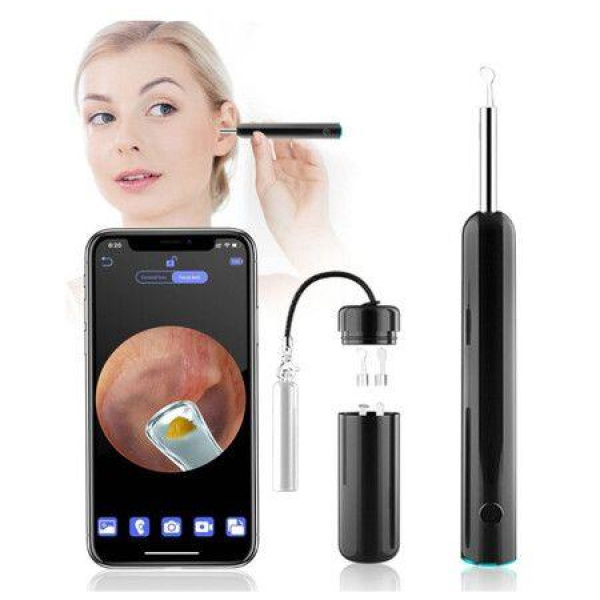 Ear Wax Removal Tool Camera Ear Cleaner Earwax Removal Kit For Adults Kids And Pets