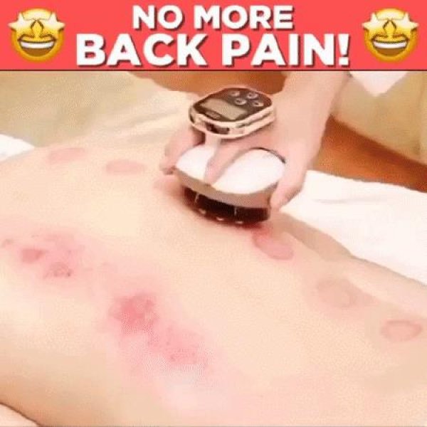 Electric Gua Sha Scraping Massage And Cupping Therapy Tool Handheld Physical Therapy Gua Sha Massage Device With Heat And Suction