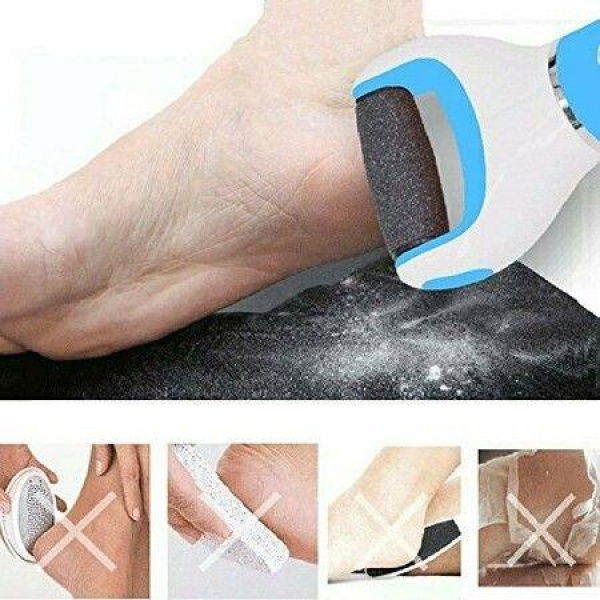 Electronic Foot File Callus Remover: Pedicure Tools Scrubber Kit Electric Shaver.