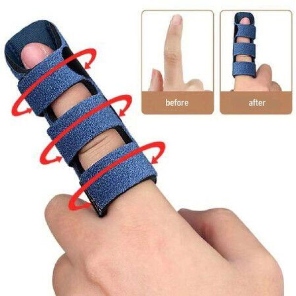 Finger Splint,Trigger Finger Splint with Belt-in Aluminum Splint Adjustment Tape Stick,For Recovery,Sports Injury,Finger Injuries Color Blue