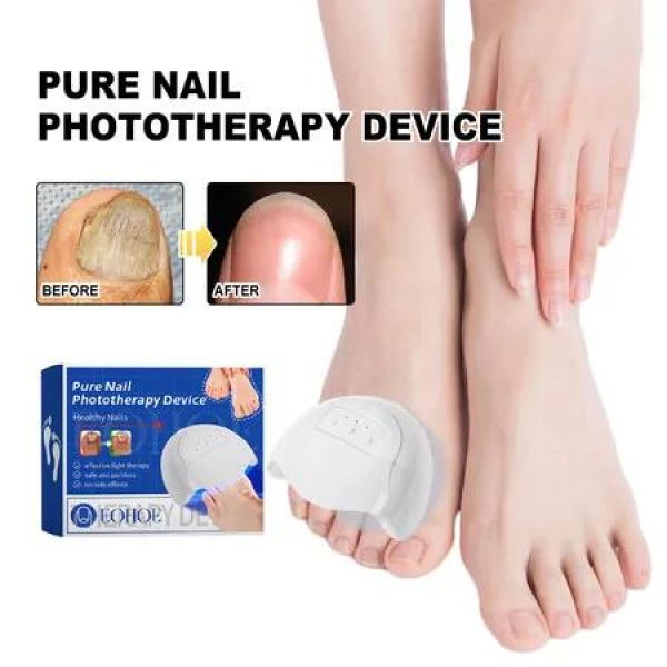 Nail Device Nail Fungus Cleaning Device Nail Fungus for Damaged Discolored Thick Toenails Fingernails