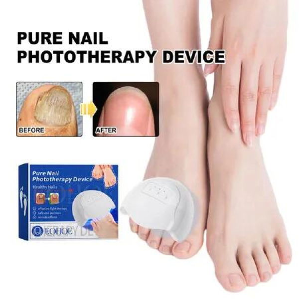 Nail Fungus Cleaner Device Damaged Discolored Thick Toenails Fingernails Treatment