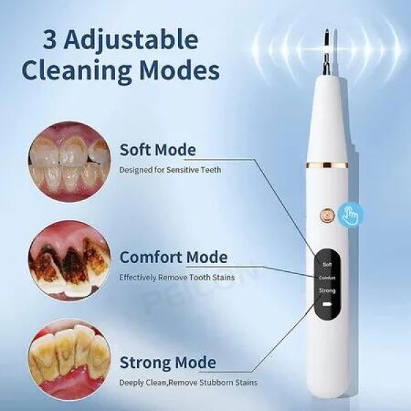 Professional Ultrasonic Dental Scaler - Effortlessly Remove Tartar and Stains