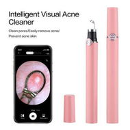 Detailed information about the product Smart Visual Blackhead Remover Acne Needle Cleansing Cosmetic Devices Acne Squeeze Pore Cleaner Facial Treatment With Camera Color Pink