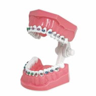Detailed information about the product Typodonts Orthodontics Demonstration Model with Metal Wires and Bracket Teaching, Learning, Interpretation Model for Men Women and Children, Metal Bracket