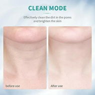 Detailed information about the product Vibration Massager Skin Tightening Device Firming Wrinkle Tool Double Chin Removal Device